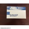 人生长激素释放因子(GH-RF)ELISA试剂盒
