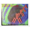 人ELISA 试剂盒供应商 ELISA 试剂盒价格