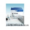 人复制蛋白A(RPA-70)ELISA 试剂盒厂家直销